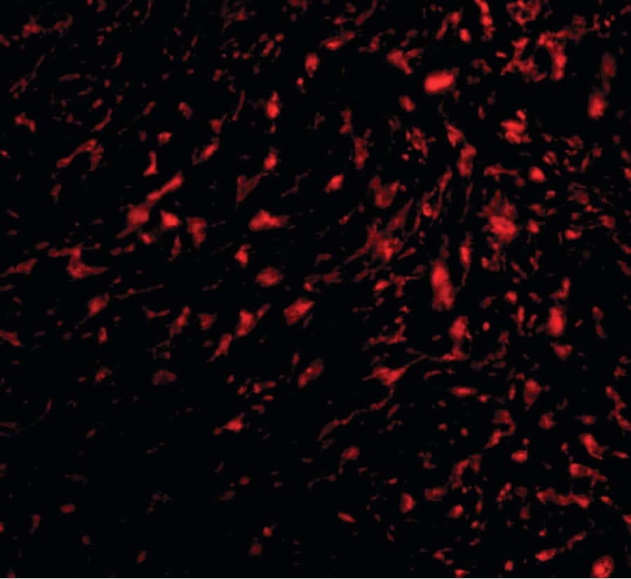 ADGRA2 / GPR124 Antibody