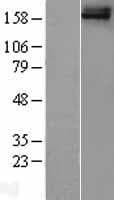 FREM1 Protein (Over-Expression Lysate Myc-DDK (Flag))