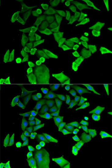 Polyclonal Rabbit anti-Human TPT1 / TCTP Antibody (IHC, IF, WB)