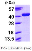 Human ARG2 / Arginase 2 Protein (Recombinant His)