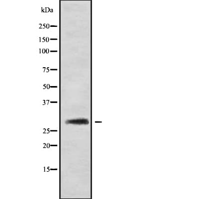 CALB1 / Calbindin Antibody