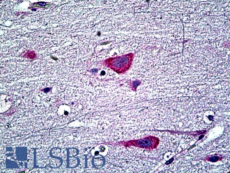 IHC-plus™ EDF1 / MBF1 Antibody (aa2-14)