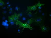 VCAM1 / CD106 Antibody (clone OTI2G5)