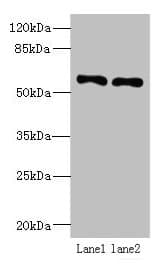 Polyclonal Rabbit anti-Human IFRD2 Antibody (IHC, WB)