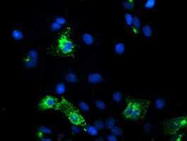 KCNJ3 / GIRK1 Antibody (aa279-501, clone OTI1C5, Carrier-free)