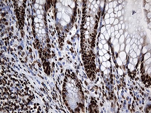 Monoclonal Mouse anti-Human PTBP3 / ROD1 Antibody (clone OTI5G7, aa300-552, IHC, WB)