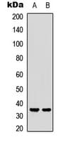 CASP3 / Caspase 3 Antibody (phospho-Ser150)