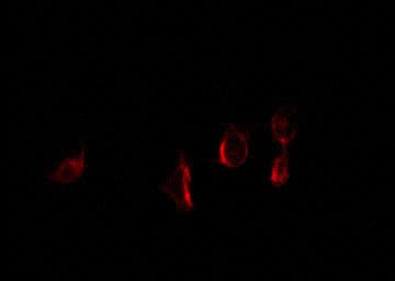 ER Alpha / Estrogen Receptor Antibody (phospho-Ser118)