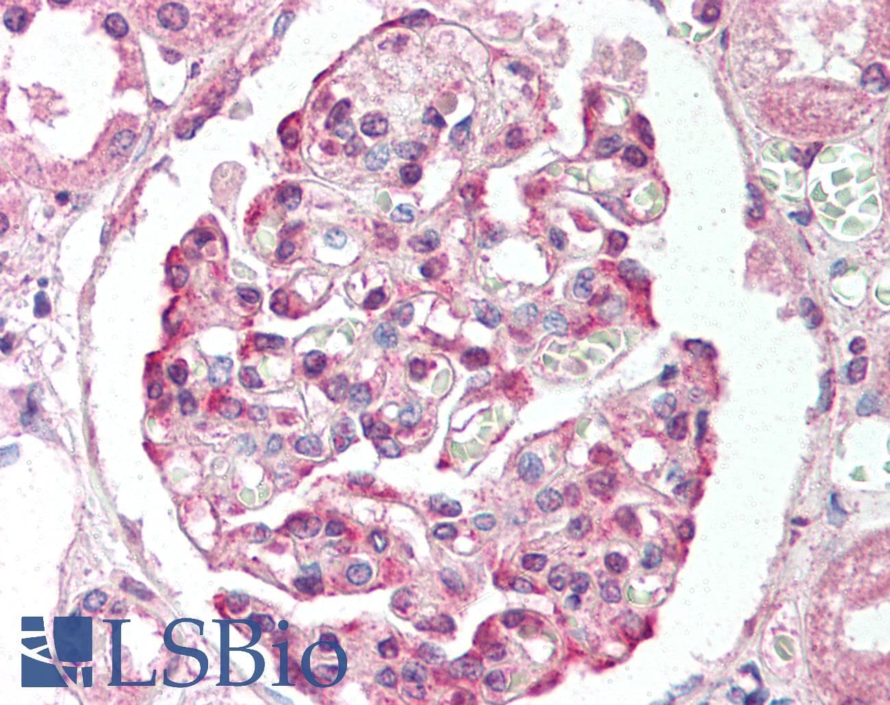IHC-plus™ Polyclonal Rabbit anti-Human PRMT7 Antibody (aa346-360, IHC, WB)