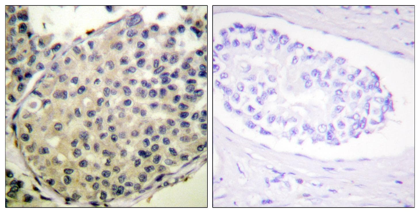 EIF4G1 / EIF4G Antibody (phospho-Ser1108)