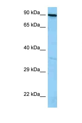 Polyclonal Rabbit anti-Human ADAP / FYB Antibody (aa646-695, WB)