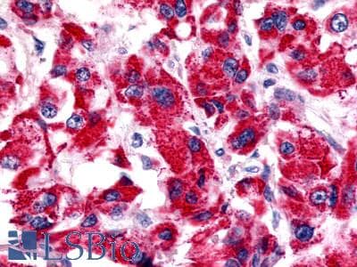 PathPlus™ BOB / GPR15 Antibody (Cytoplasmic Domain)