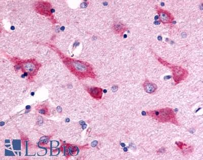 PathPlus™ ADGRG6 / GPR126 Antibody (C-Terminus)