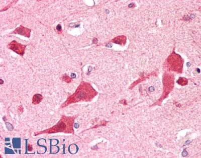 IHC-plus™ Polyclonal Goat anti-Human DDX6 Antibody (aa471-483, IHC, WB)