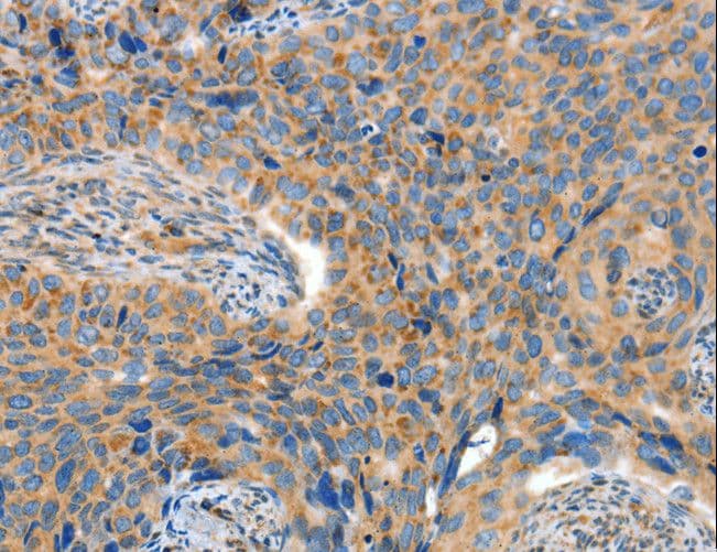 Polyclonal Rabbit anti-Human ADAMTS18 Antibody (IHC)