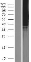 ZNF384 Protein (Over-Expression Lysate Myc-DDK (Flag))