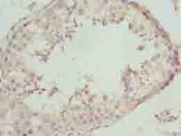 NBPF3 Antibody