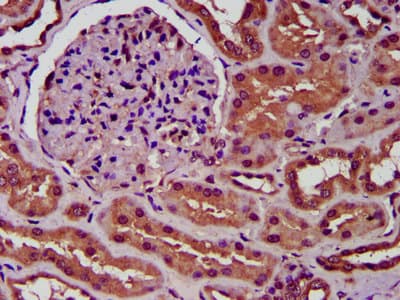 SLC34A3 / NaPi-2c Antibody