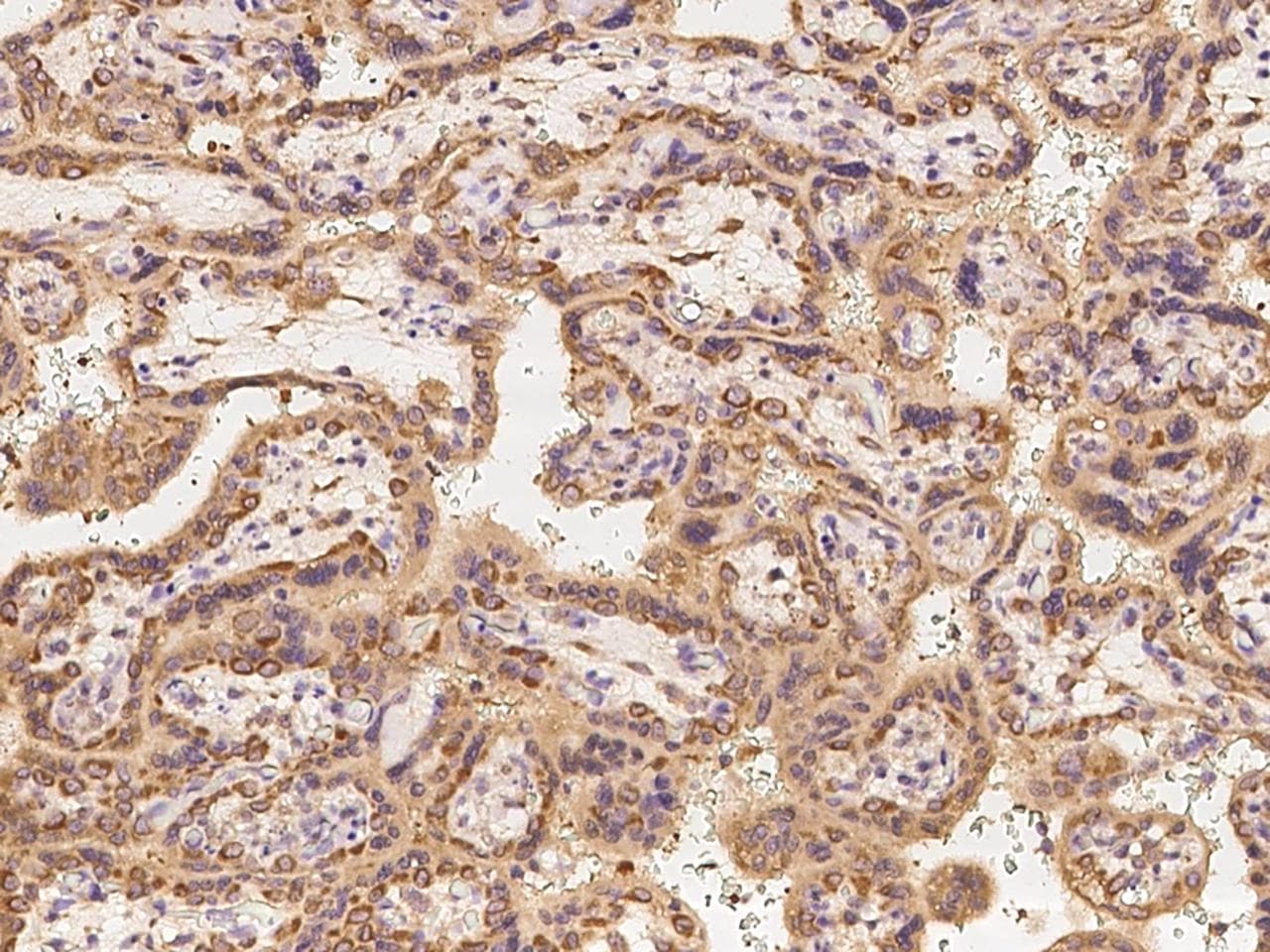 Polyclonal Rabbit anti-Human DENR / Density Regulated Antibody (IHC, IF, WB)