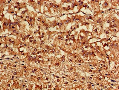 Polyclonal Rabbit anti-Human CASK Antibody
