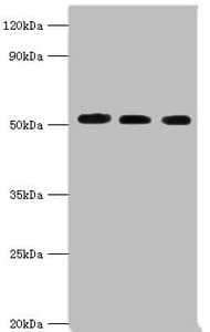 Polyclonal Rabbit anti-Human PDCD4 Antibody (aa1-260, WB)