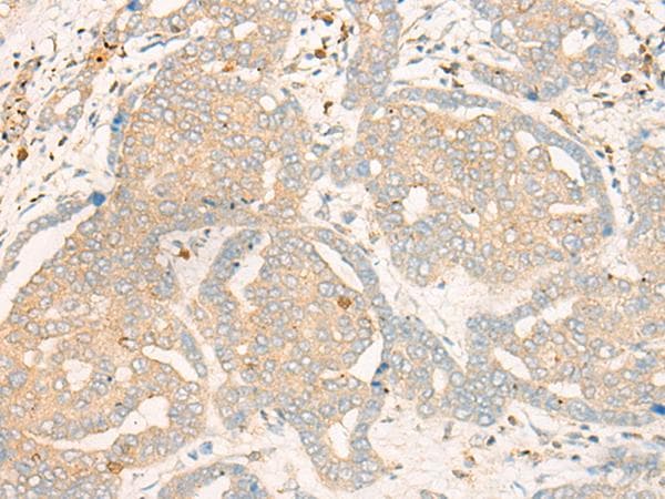 FBXO32 / Fbx32 Antibody