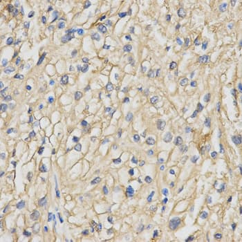 Polyclonal Rabbit anti-Human RACGAP1 / MGCRACGAP Antibody (IHC, IF, WB)