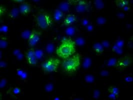 LIPG / Endothelial Lipase Antibody (clone OTI2E12, Carrier-free)