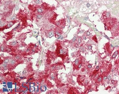 NBR1 Antibody (aa776-825)
