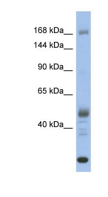 CHD1 Antibody (aa1331-1380)