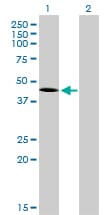 Monoclonal Mouse anti-Human TBXT / T / Brachyury Antibody (clone 5H8, WB)