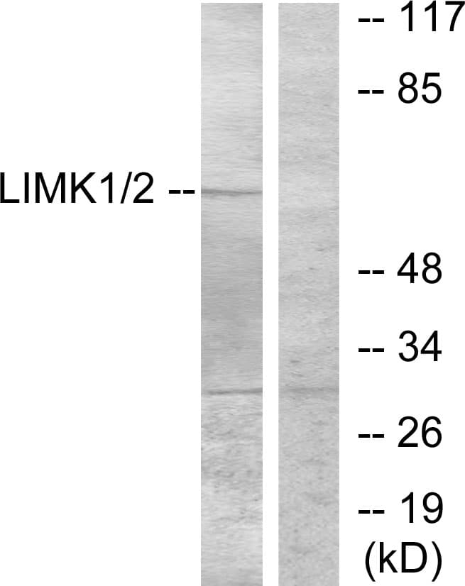Polyclonal Rabbit anti-Human LIMK1 / LIMK Antibody (aa471-520, WB)