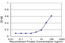 BABP / AKR1C2 Antibody (clone 1G1)