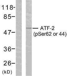 ATF2 Antibody (phospho-Ser62)
