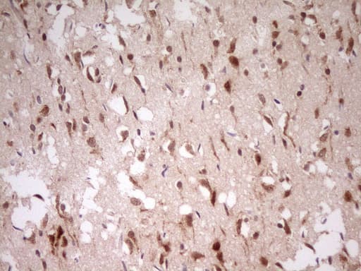 Monoclonal Mouse anti-Human MYL4 Antibody (clone OTI1H6, Carrier-free, aa2-197, IHC, WB)