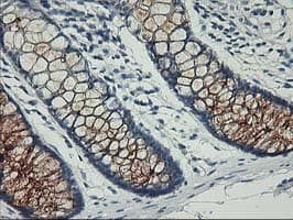 Nectin-1 / PVRL1 Antibody (clone OTI6F8)