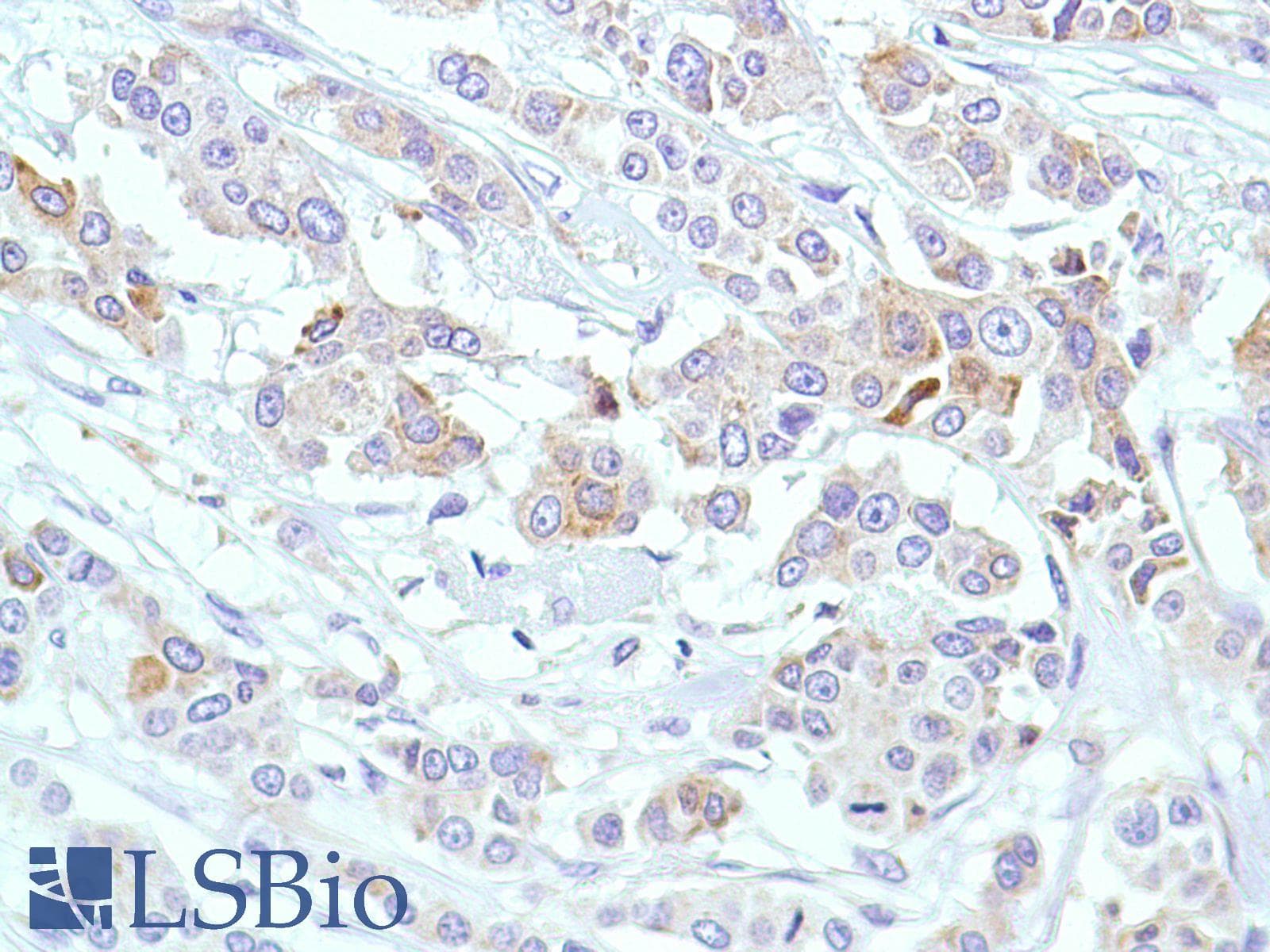 PTGS2 / COX2 / COX-2 Antibody (C-Terminus, clone SP21)