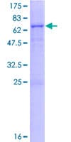 Human PLA2G15 / ACS Protein (Recombinant GST)