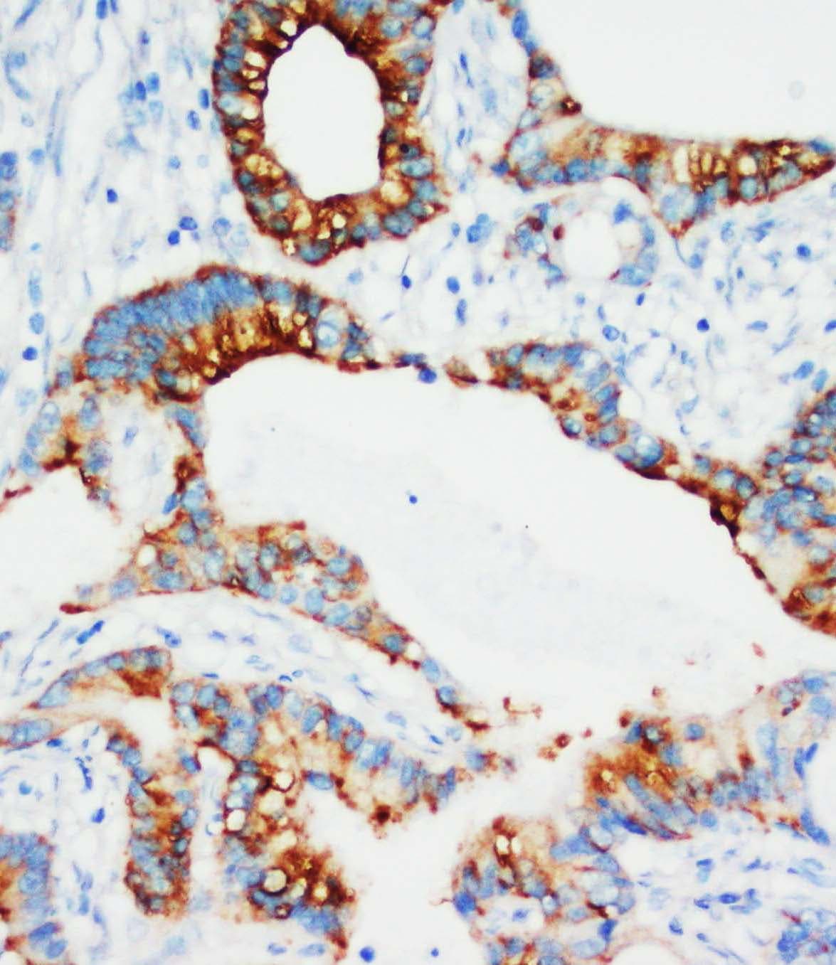 IGFBP3 Antibody (aa182-198)