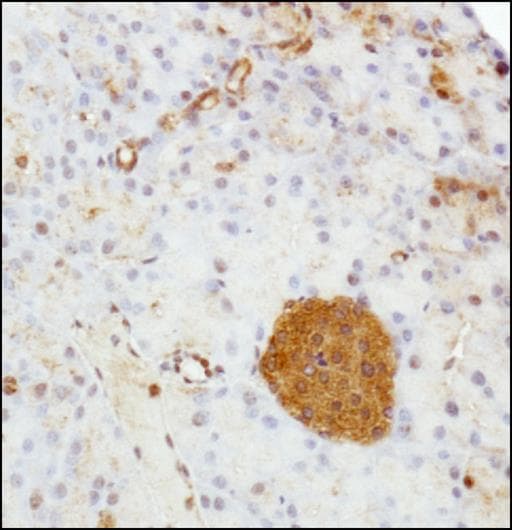 SERPINE1 / PAI-1 Antibody (aa300-400)