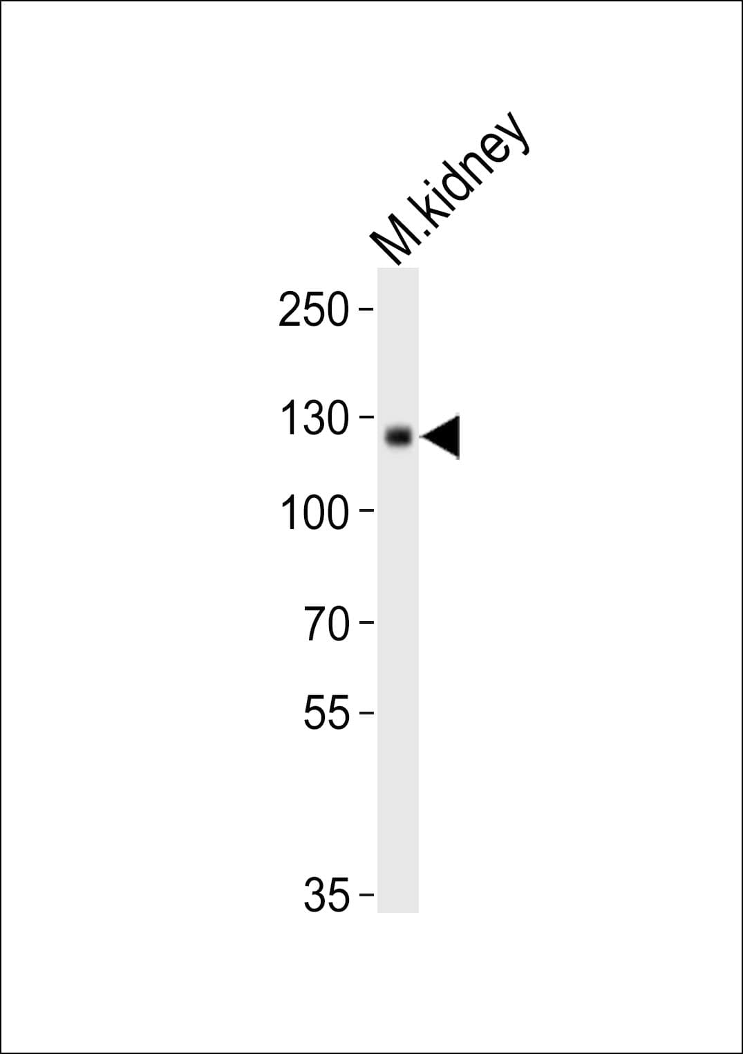 Polyclonal Rabbit anti-Human NEP / DDR1 Antibody (aa396-430, WB)