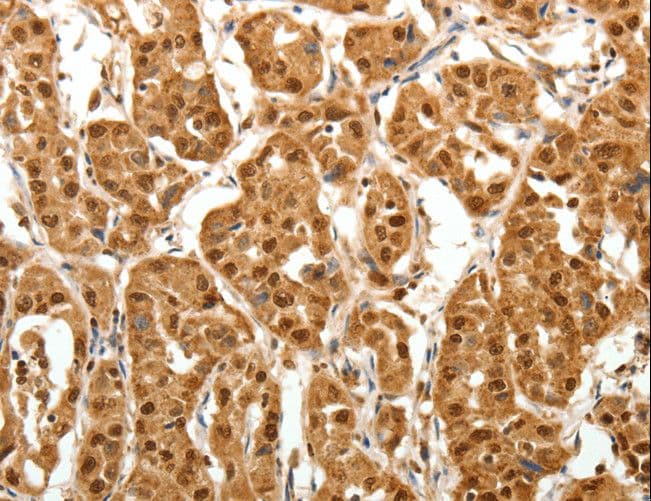 TNN / Tenascin N Antibody