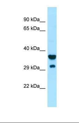 SIRPG Antibody (aa100-148)