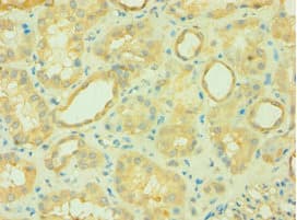 CARD10 / CARMA3 Antibody (aa863-1032)