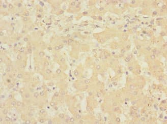 RCHY1 / PIRH2 Antibody