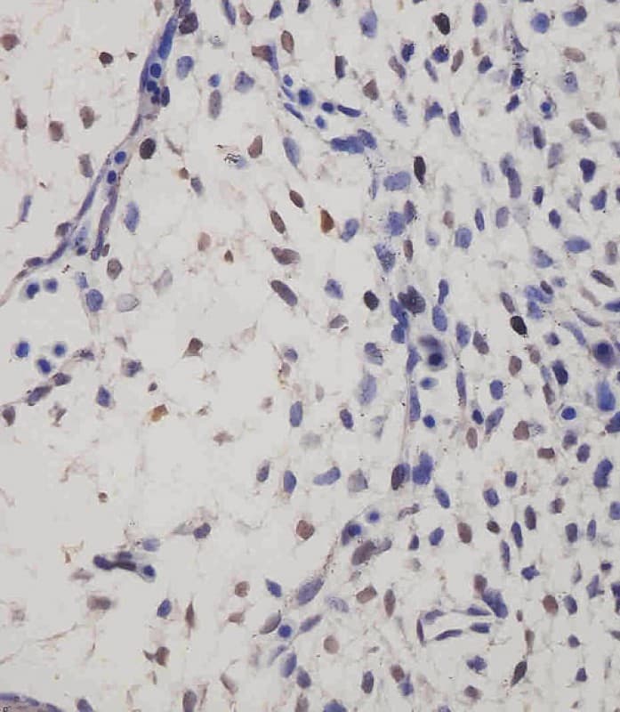 SUFU Antibody (clone 1783CT536.263.29)