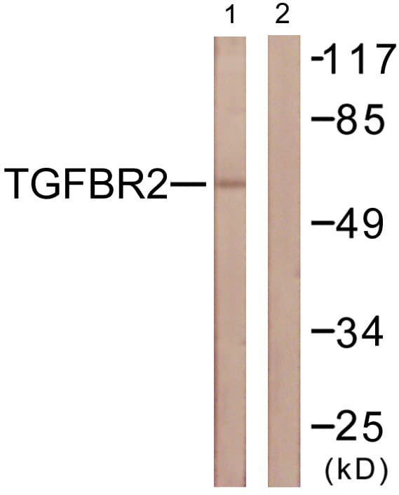 TGFBR2 Antibody (aa191-240)
