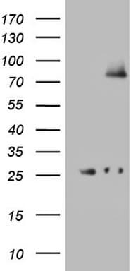 ALDP / ABCD1 Antibody (aa508-745, clone OTI4E2)