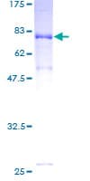 Human AK9 / AKD1 / AKD2 Protein (Recombinant GST)