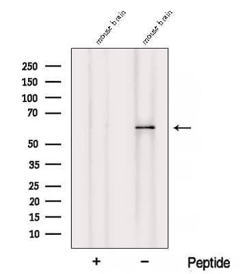 Polyclonal Rabbit anti-Human ZNF238 Antibody (IF, WB)